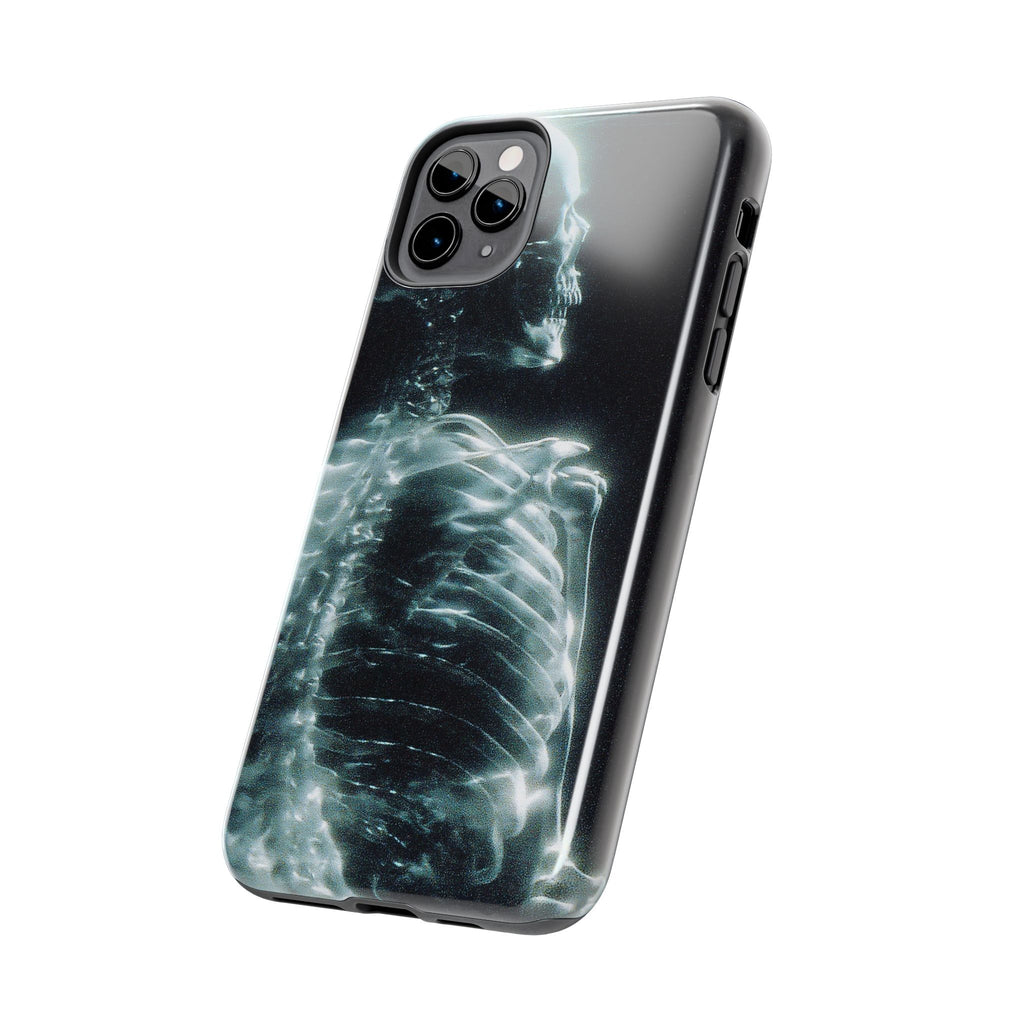 X ray phone case