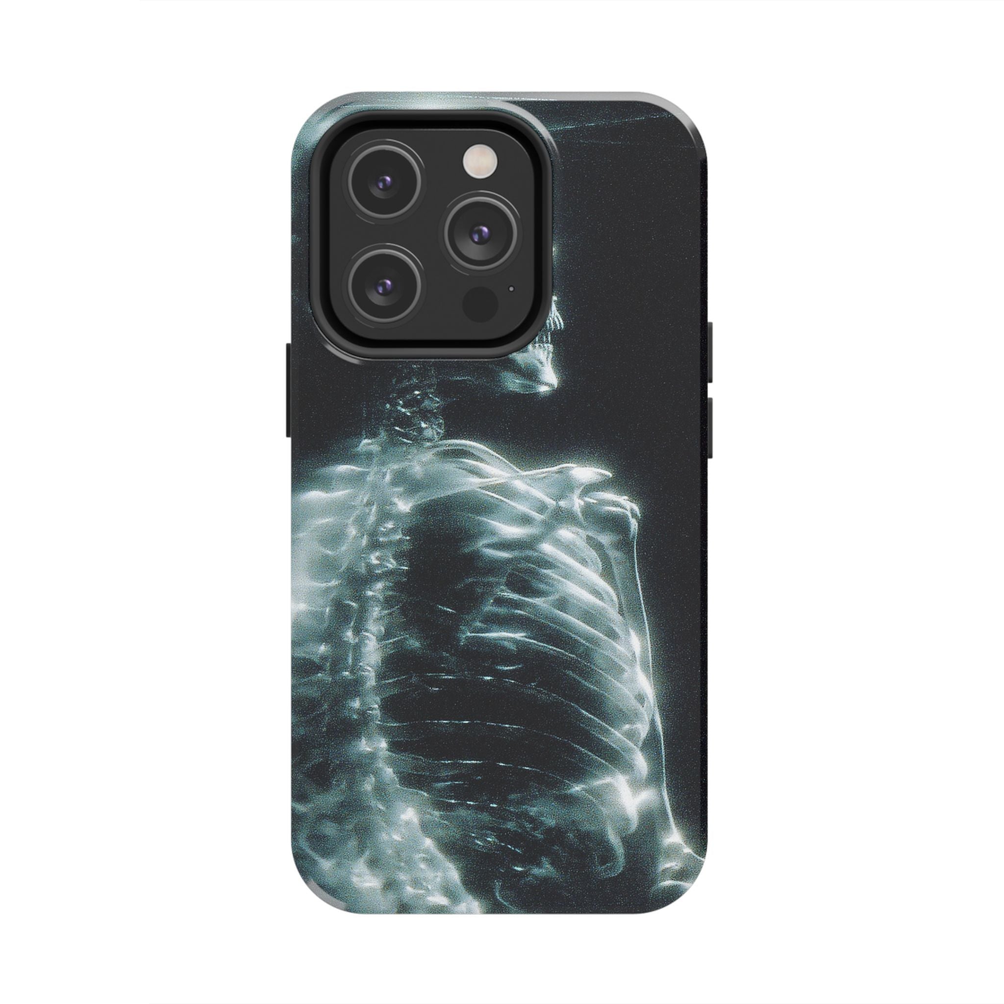 X ray phone case
