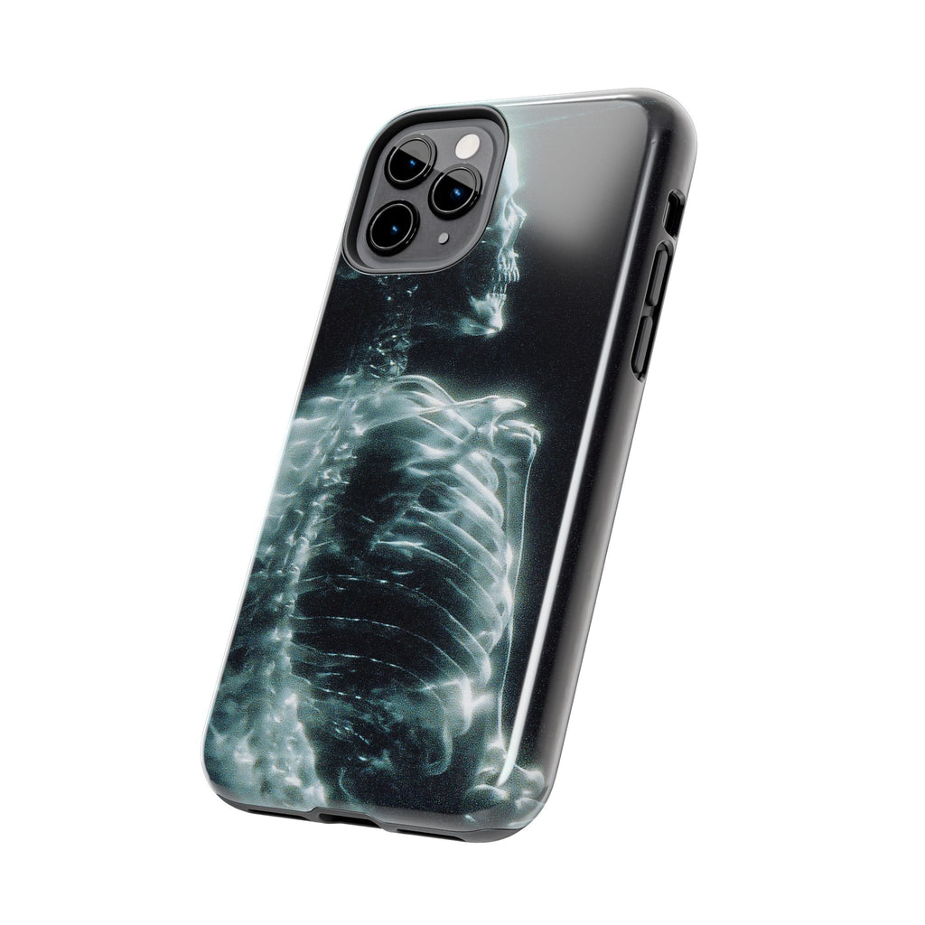 X ray phone case
