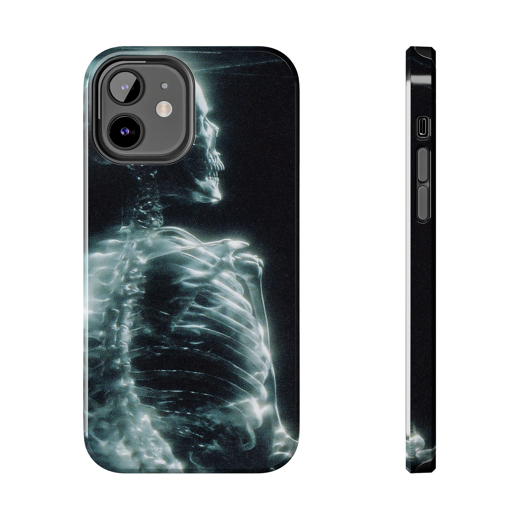 X ray phone case