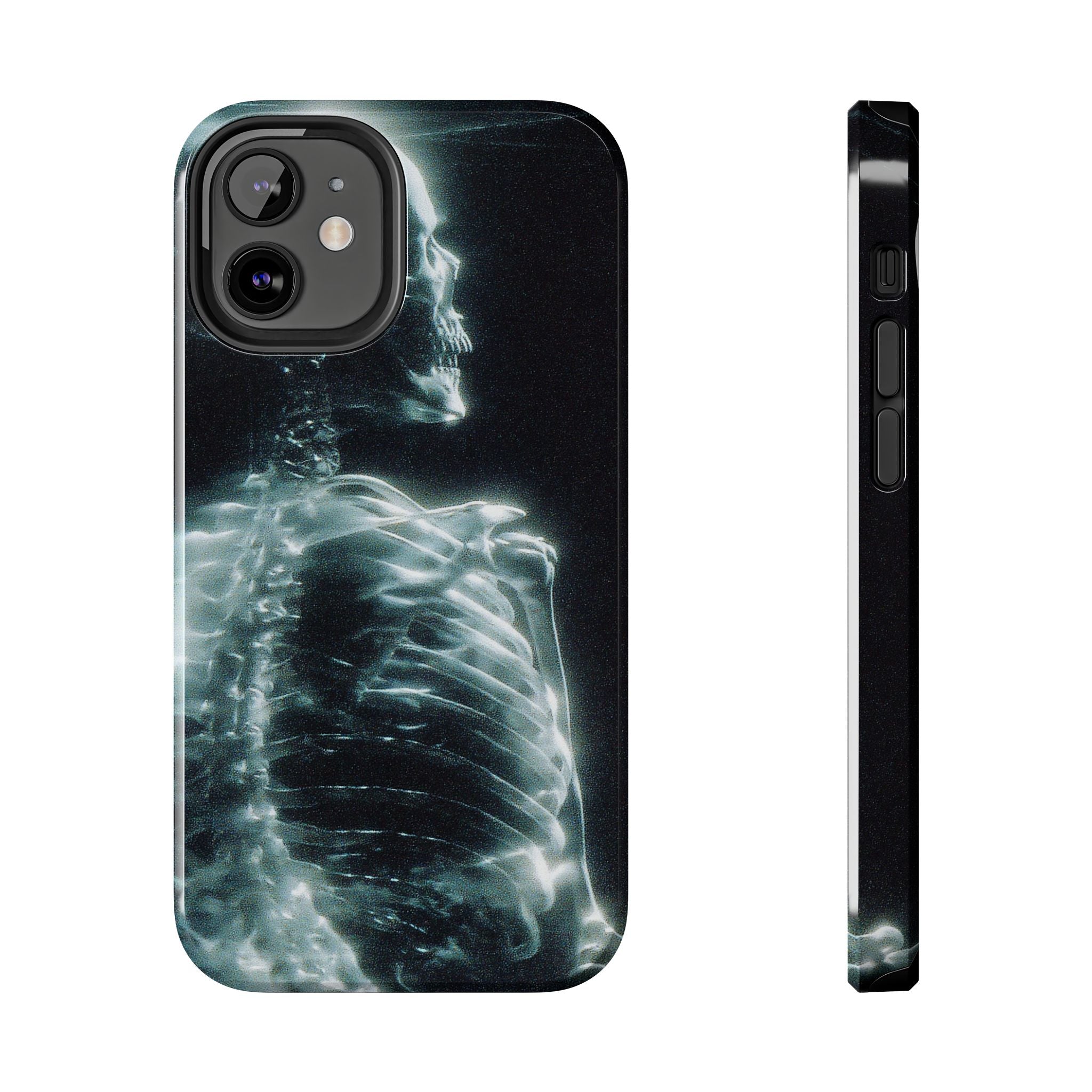 X ray phone case