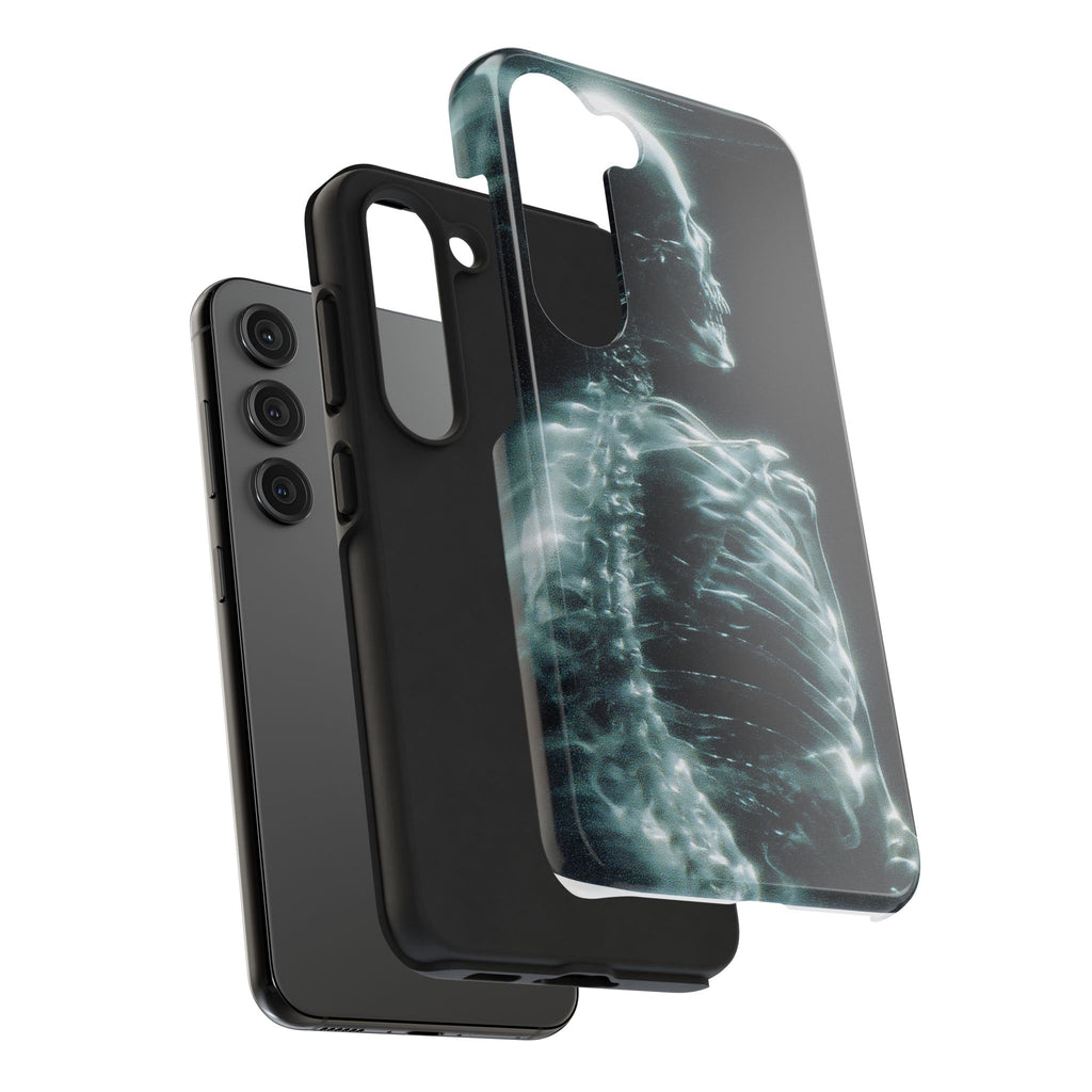 X ray phone case