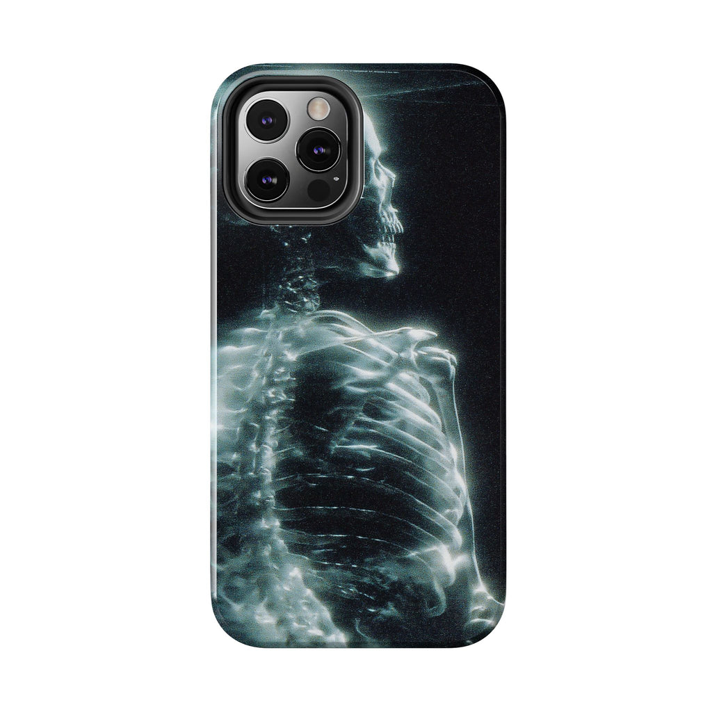 X ray phone case