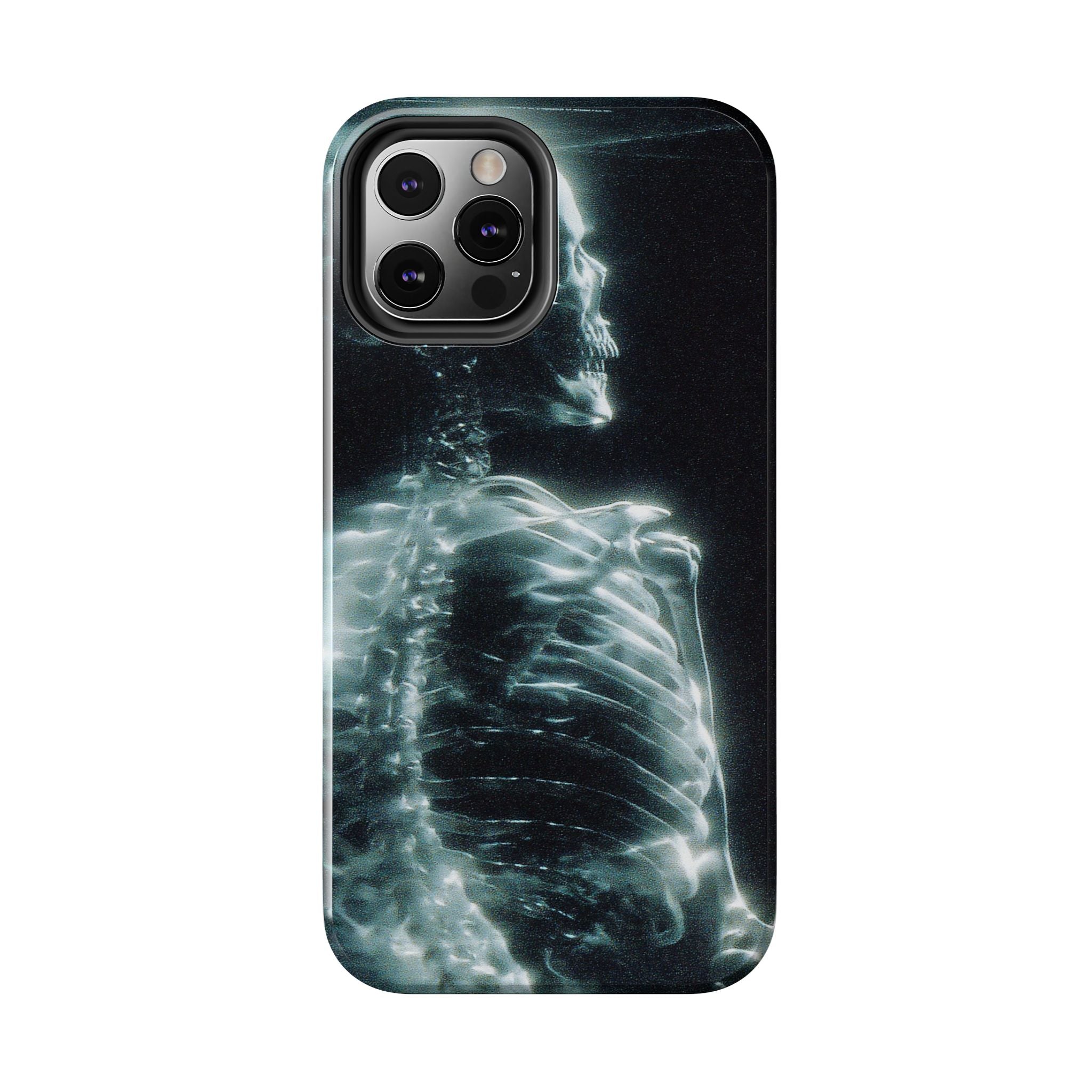 X ray phone case